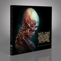 Severe Torture - Torn from the Jaws of Death [CD / Vinyl] thumbnail 1